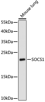 Western blot - SOCS1 Polyclonal Antibody 