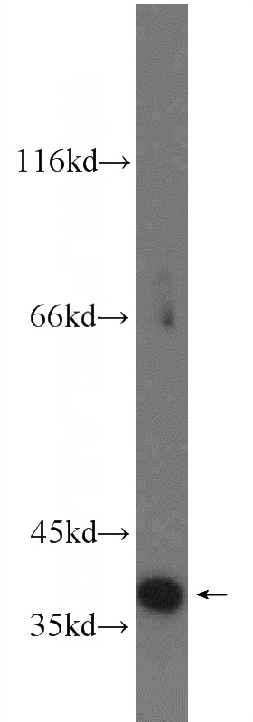Jurkat cells were subjected to SDS PAGE followed by western blot with Catalog No:109166(CDK6 antibody) at dilution of 1:2000