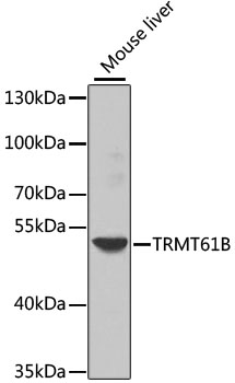 Western blot - TRMT61B Polyclonal Antibody 