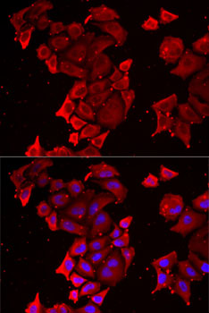 Immunofluorescence - TIMM17A Polyclonal Antibody 