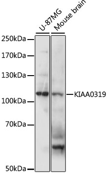Western blot - KIAA0319 Polyclonal Antibody 