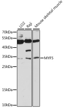 Western blot - MYF5 Polyclonal Antibody 