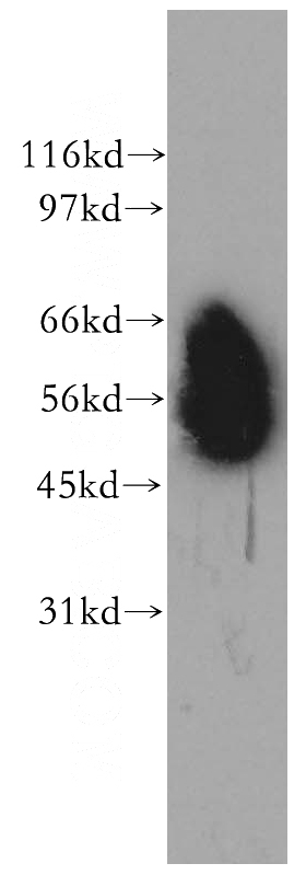 A549 cells were subjected to SDS PAGE followed by western blot with Catalog No:109126(CD46 antibody) at dilution of 1:400