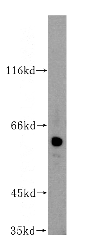 human placenta tissue were subjected to SDS PAGE followed by western blot with Catalog No:110830(GAL3ST4 antibody) at dilution of 1:500