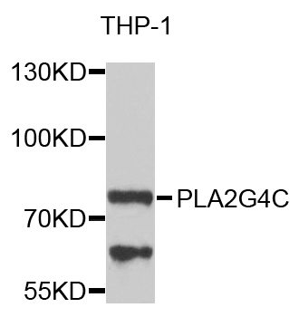 Western blot - PLA2G4C Polyclonal Antibody 