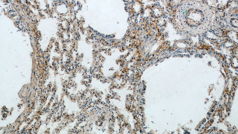 Immunohistochemical of paraffin-embedded human lung using Catalog No:113915(PIP5K1B antibody) at dilution of 1:100 (under 10x lens)