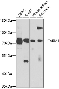 Western blot - CARM1 Polyclonal Antibody 