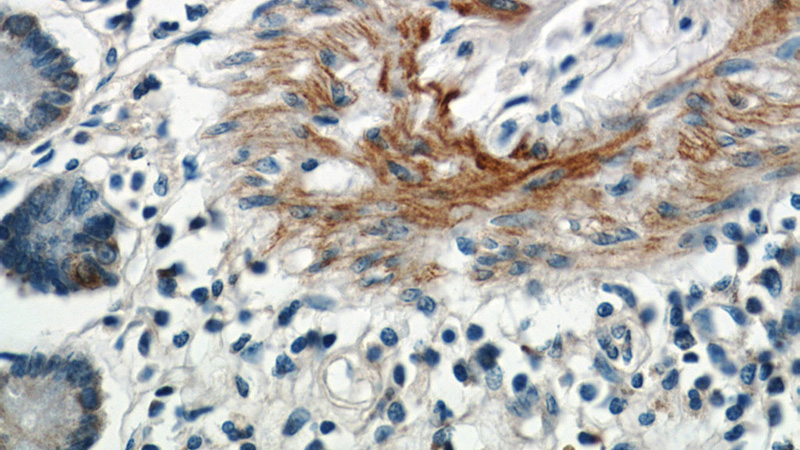 Immunohistochemistry of paraffin-embedded human small intestine tissue slide using Catalog No:112604(MGP Antibody) at dilution of 1:50 (under 40x lens)