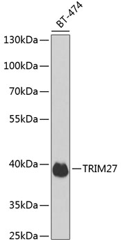 Western blot - TRIM27 Polyclonal Antibody 