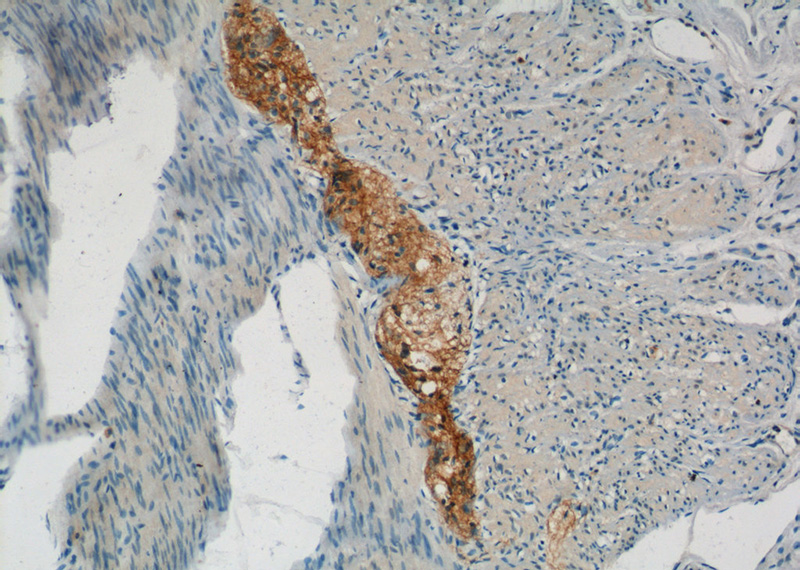 Immunohistochemistry of paraffin-embedded human small intestine tissue slide using Catalog No:117133(BTC Antibody) at dilution of 1:50 (under 10x lens)