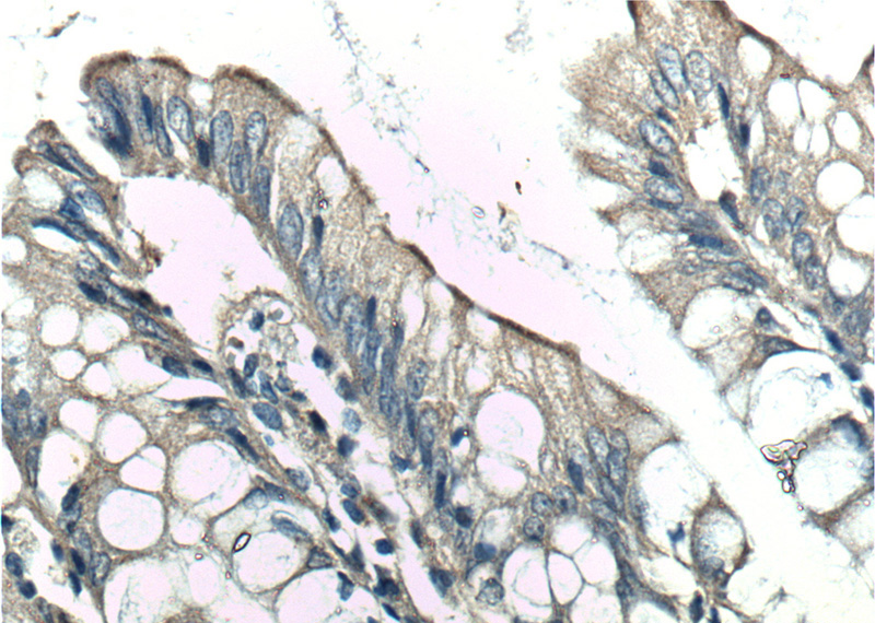 Immunohistochemistry of paraffin-embedded human colon tissue slide using Catalog No:109341(Claudin 3 Antibody) at dilution of 1:100 (under 40x lens).