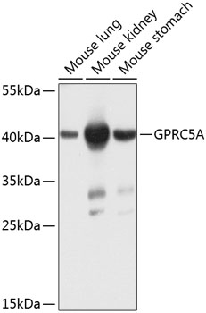 Western blot - GPRC5A Polyclonal Antibody 