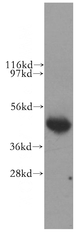 human brain tissue were subjected to SDS PAGE followed by western blot with Catalog No:112220(LIAS antibody) at dilution of 1:500