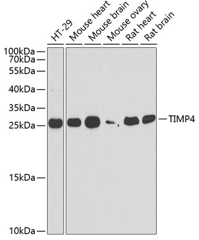 Western blot - TIMP4 Polyclonal Antibody 