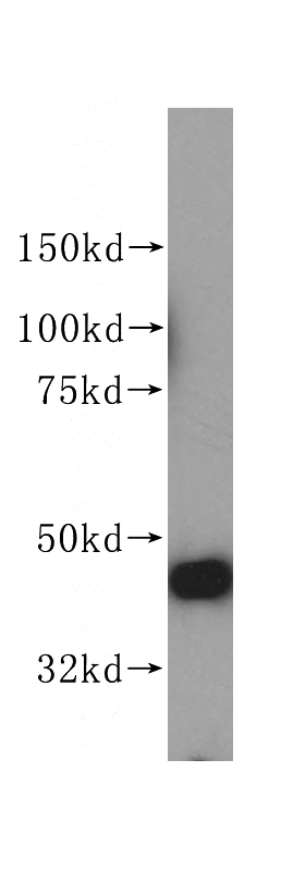 HepG2 cells were subjected to SDS PAGE followed by western blot with Catalog No:113783(PGD antibody) at dilution of 1:500