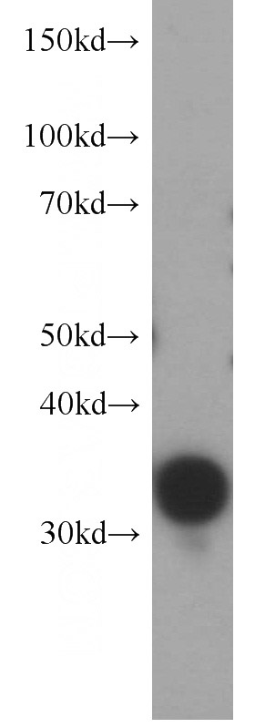HeLa cells were subjected to SDS PAGE followed by western blot with Catalog No:116115(TYMS antibody) at dilution of 1:1500
