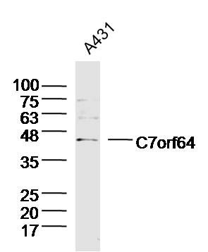 Fig1: Sample:A431 Cell (Human) Lysate at 40 ug; Primary: Anti-C7orf64 at 1/300 dilution; Secondary: IRDye800CW Goat Anti-Rabbit IgG at 1/20000 dilution; Predicted band size: 42kD; Observed band size: 42kD