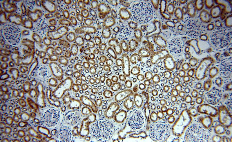 Immunohistochemical of paraffin-embedded human kidney using Catalog No:113080(NDUFC2 antibody) at dilution of 1:400 (under 10x lens)