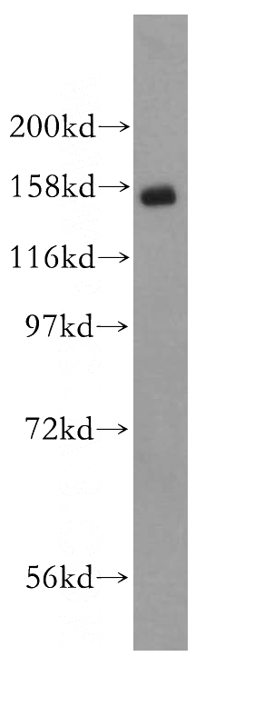 K-562 cells were subjected to SDS PAGE followed by western blot with Catalog No:115762(SYMPK antibody) at dilution of 1:500