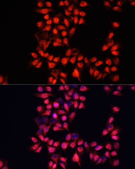 Immunofluorescence - ADAM10 Polyclonal Antibody 