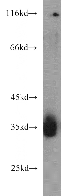 A375 cells were subjected to SDS PAGE followed by western blot with Catalog No:116137(TIMMDC1 antibody) at dilution of 1:1000