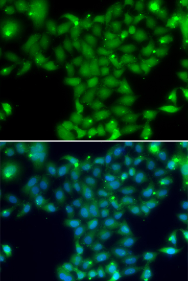 Immunofluorescence - TGM5 Polyclonal Antibody 