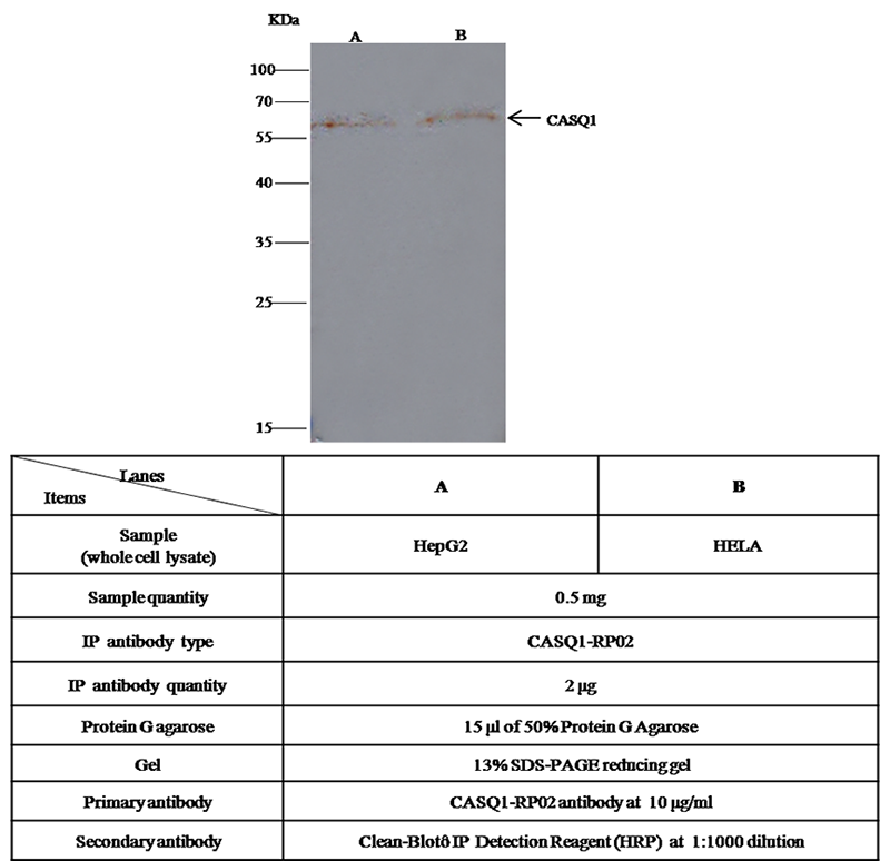 Human Calsequestrin-1 / CASQ1 Immunoprecipitation(IP) 15209