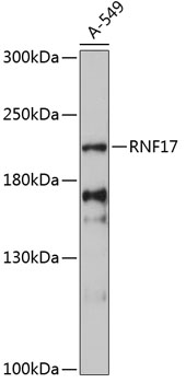 Western blot - RNF17 Polyclonal Antibody 