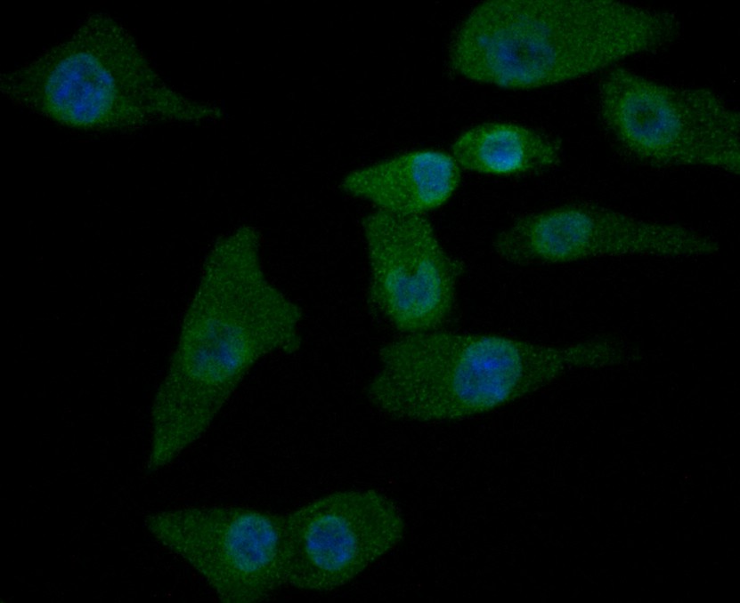 Fig2: ICC staining NRCAM in A549 cells (green). The nuclear counter stain is DAPI (blue). Cells were fixed in paraformaldehyde, permeabilised with 0.25% Triton X100/PBS.
