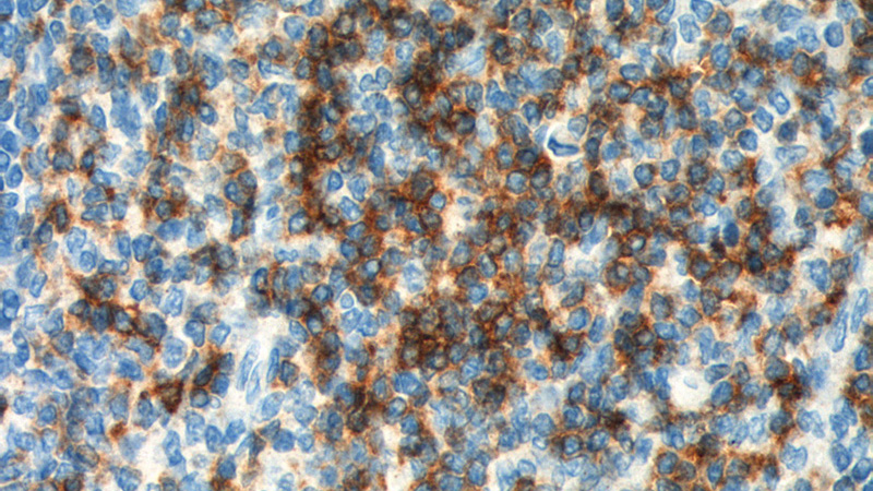 Immunohistochemistry of paraffin-embedded human tonsillitis tissue slide using Catalog No:109128(CD5 Antibody) at dilution of 1:200 (under 40x lens). heat mediated antigen retrieved with Tris-EDTA buffer(pH9).