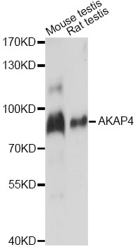 Western blot - AKAP4 Polyclonal Antibody 