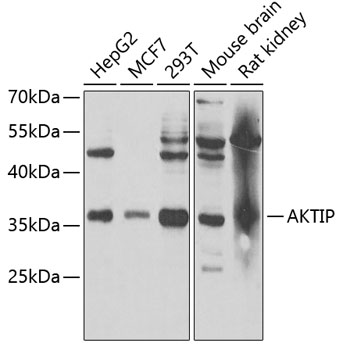 Western blot - AKTIP Polyclonal Antibody 