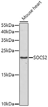 Western blot - SOCS2 Polyclonal Antibody 