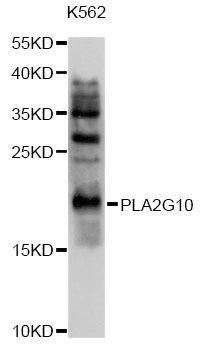 Western blot - PLA2G10 Polyclonal Antibody 