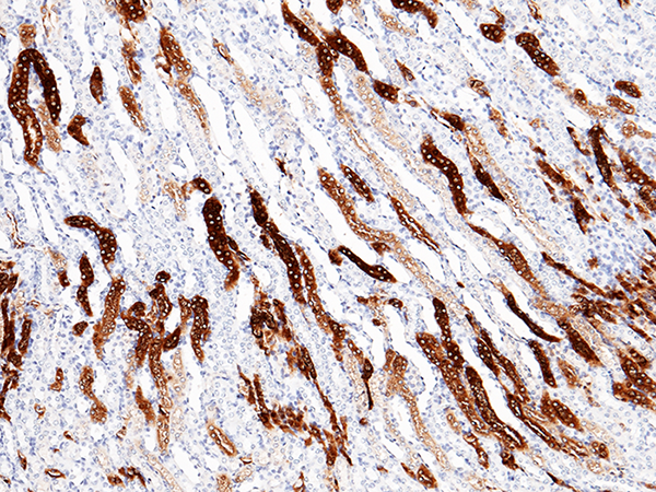 MEP1A Antibody, Rabbit MAb, Immunohistochemistry