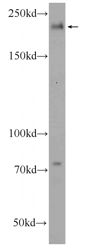 HEK-293 cells were subjected to SDS PAGE followed by western blot with Catalog No:110914(TUBGCP6 Antibody) at dilution of 1:1000
