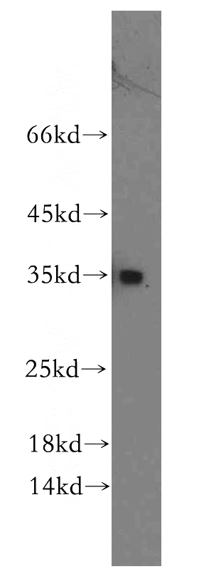human brain tissue were subjected to SDS PAGE followed by western blot with Catalog No:114571(RCAN2 antibody) at dilution of 1:300