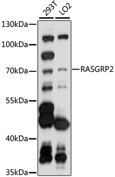 Western blot - RASGRP2 Polyclonal Antibody 