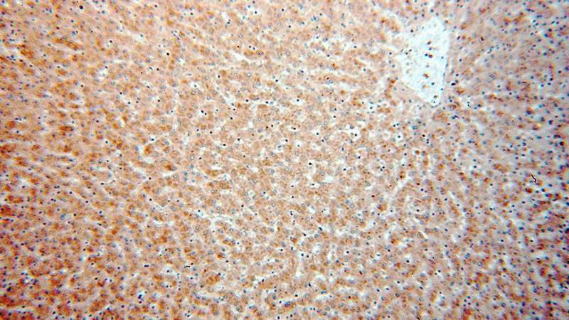 Immunohistochemical of paraffin-embedded human liver using Catalog No:114262(PTCH1 antibody) at dilution of 1:50 (under 10x lens)