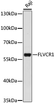 Western blot - FLVCR1 Polyclonal Antibody 