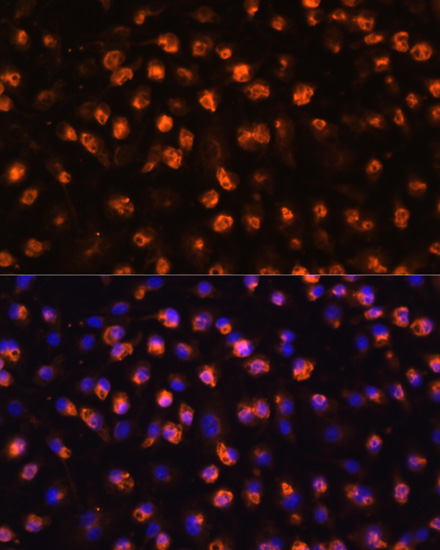 Immunofluorescence - CD11B Polyclonal Antibody 