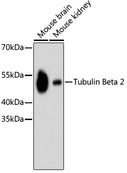 Western blot - Tubulin Beta 2 Monoclonal Antibody 