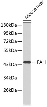 Western blot - FAH Polyclonal Antibody 