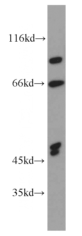 human brain tissue were subjected to SDS PAGE followed by western blot with Catalog No:110913(GCOM1 antibody) at dilution of 1:1500