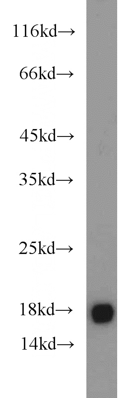 HEK-293 cells were subjected to SDS PAGE followed by western blot with Catalog No:112711(UBE2V2 antibody) at dilution of 1:1500