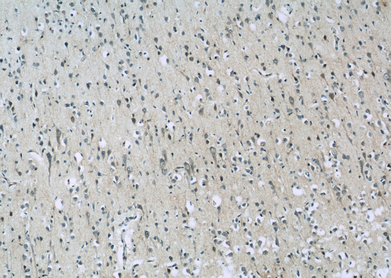 Immunohistochemistry of paraffin-embedded human brain slide using Catalog No:108046(AQR Antibody) at dilution of 1:50