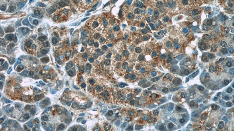 Immunohistochemistry of paraffin-embedded human pancreas tissue slide using Catalog No:116823(WFDC3 Antibody) at dilution of 1:50 (under 40x lens)