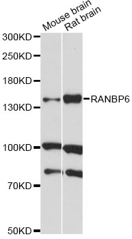 Western blot - RANBP6 Polyclonal Antibody 