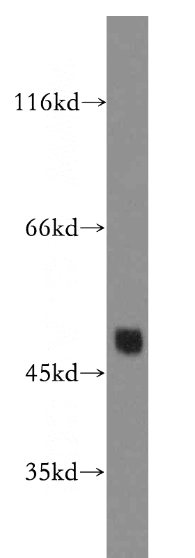human brain tissue were subjected to SDS PAGE followed by western blot with Catalog No:109455(GJA3 antibody) at dilution of 1:100
