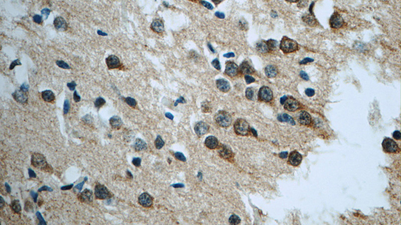 Immunohistochemistry of paraffin-embedded human brain tissue slide using Catalog No:114698(RIC8A Antibody) at dilution of 1:50 (under 40x lens)